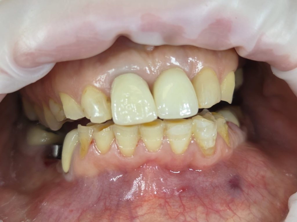caz-boja-costin-3
