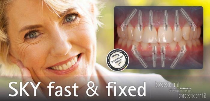 implant dentar bredent fast and fixed bucuresti