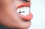 cauze bruxism