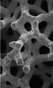 Trabecular porozitate
