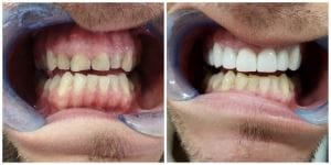 fatete-dentare-miko-2-1024×512