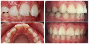 miko-ortodontie-small