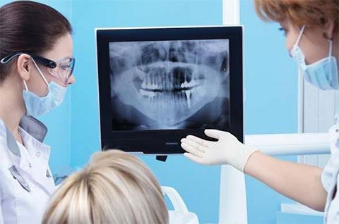Pretul unui implant dentar