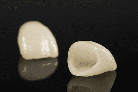 Coroana dentara zirconiu