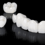 Zirconiul dentar si aplicatiile lui in implantologie
