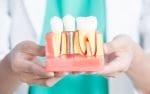 Implant dentar diabet