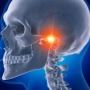 Tulburarile articulatiei temporo-mandibulare: cauze si simptome