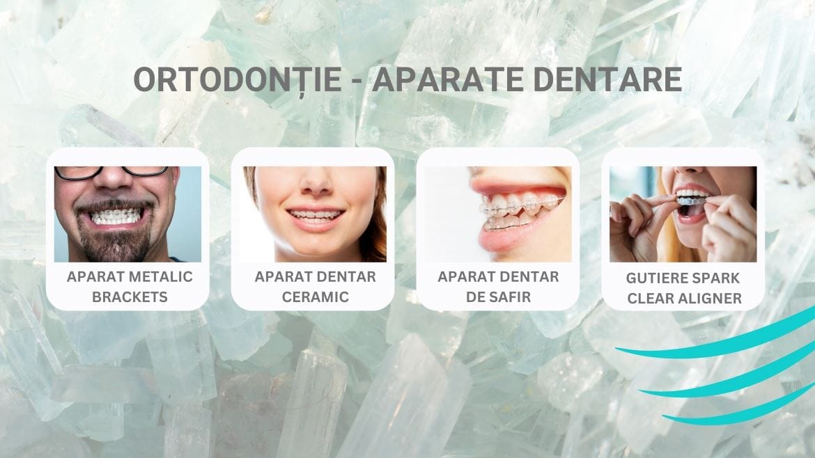 Aparate dentare – Comparație completă între opțiunile disponibile pentru adulți și copii