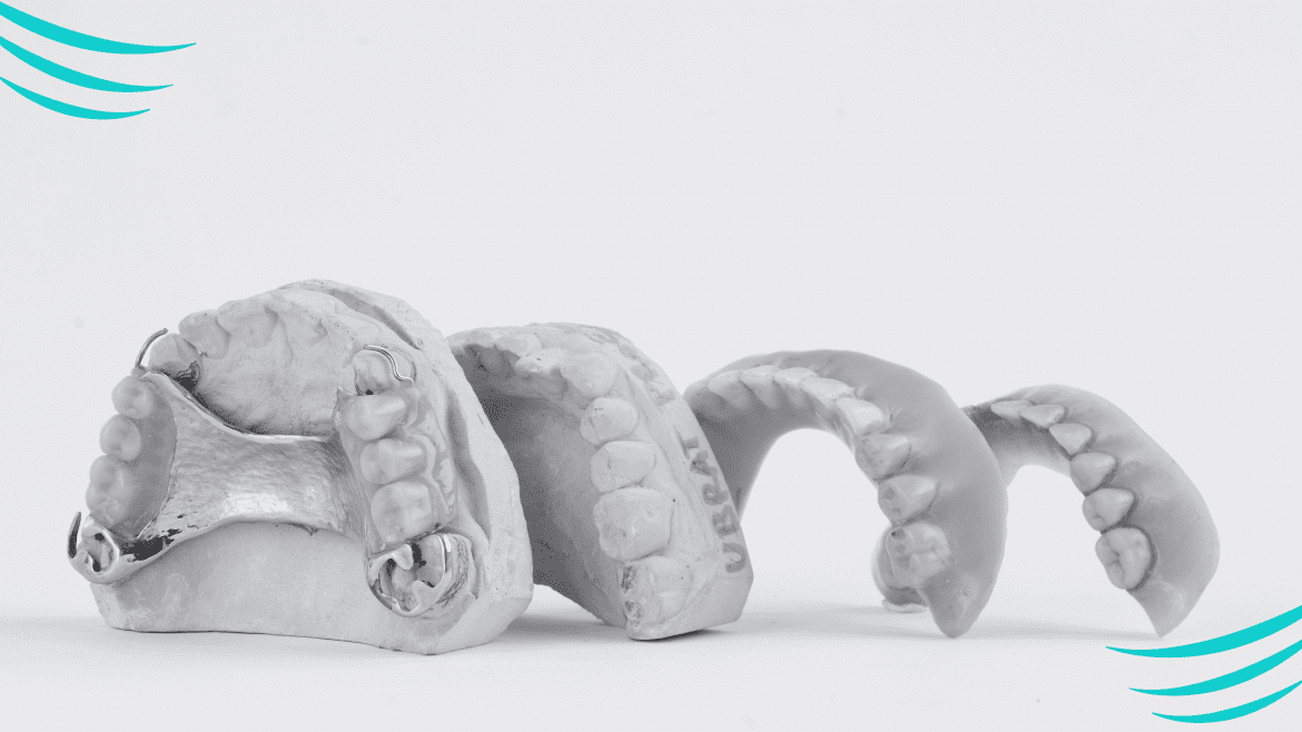 Proteza pe implanturi – alternativa modernă la proteza clasică