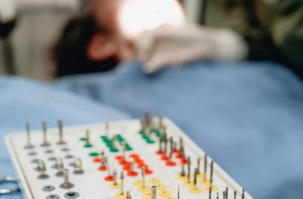 Etapele implantului dentar: ce trebuie să știi pas cu pas