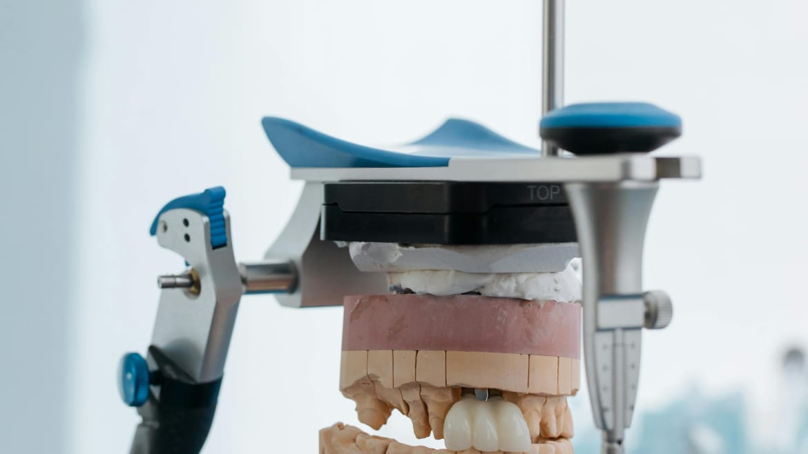 Parodontoza: Simptome timpurii și strategii de prevenție eficientă