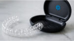aparat dentar spark
