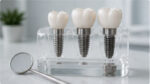 tipuri de implant dentar