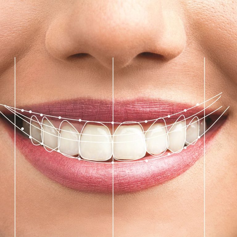Digital Smile Design