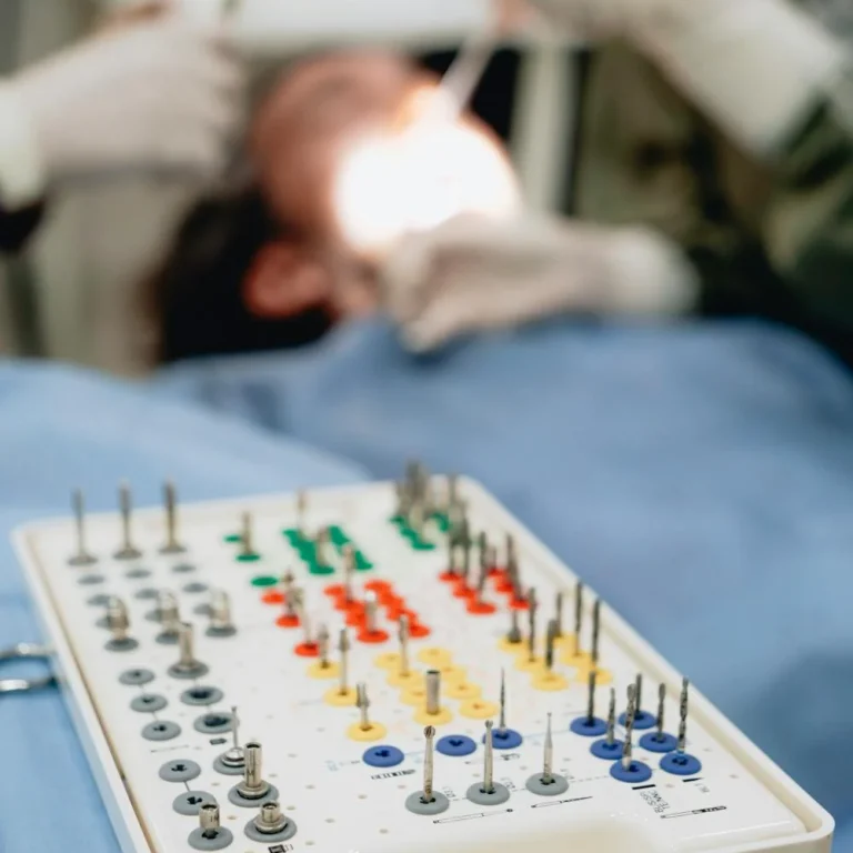 Adiția de os: când este necesară și cum o poți preveni - Miko Dental