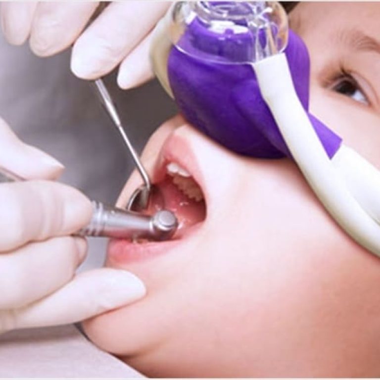 Inhalosedare dentist