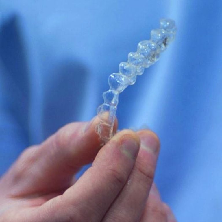 Aparat dentar invizibil Invisalign