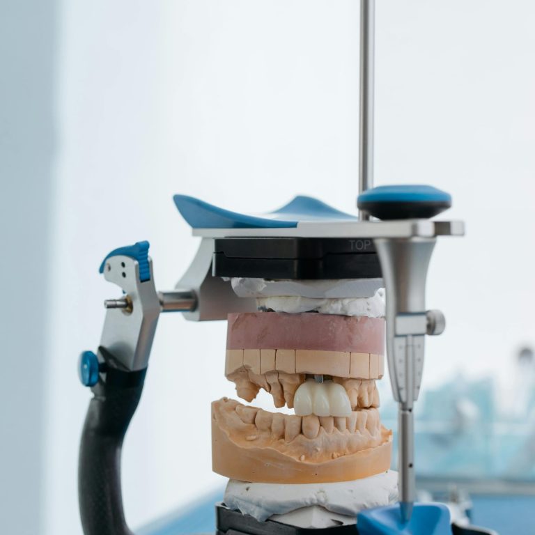 Adiția de os: când este necesară și cum o poți preveni - Miko Dental