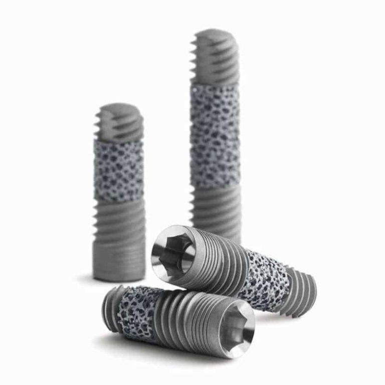 Implantul dentar Zimmer Trabecular: avantaje si caracteristici