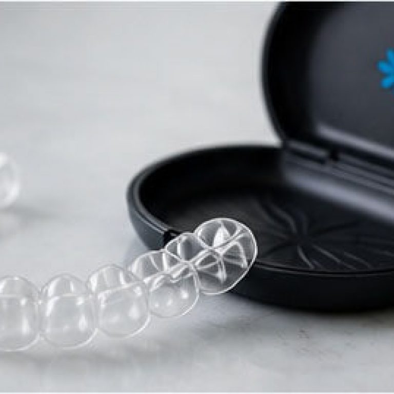 aparat dentar spark