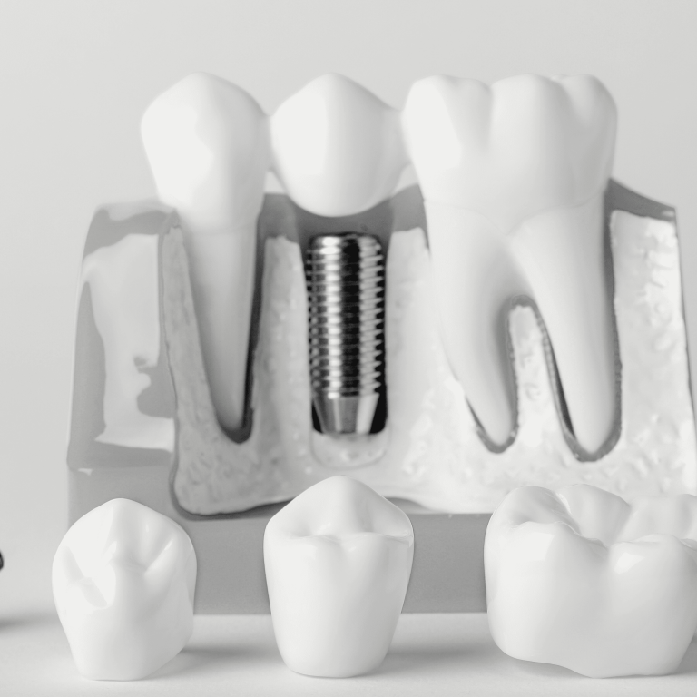 coroane dentare banner
