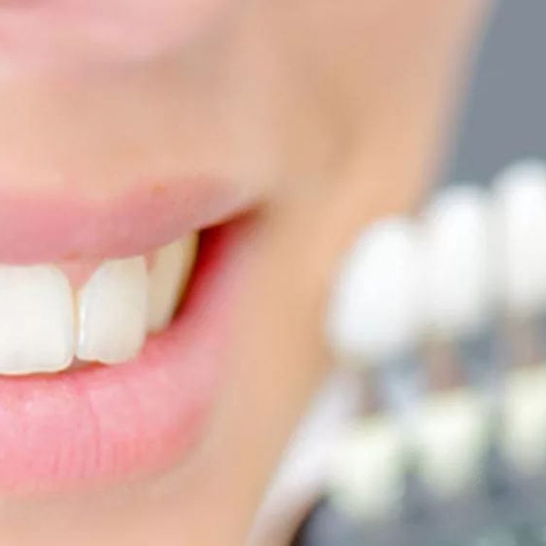 decolorarea dintilor