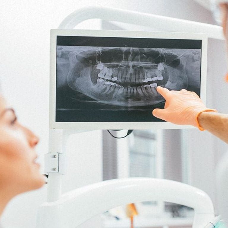 inserare evaluare os implant dentar