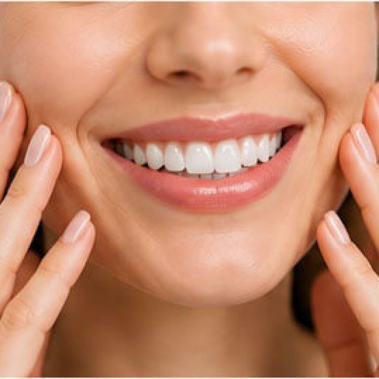 fatete dentare bucuresti