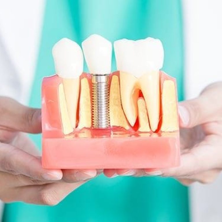 Implant dentar diabet