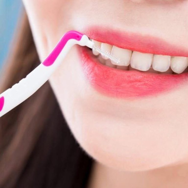 igiena-implant-dentar