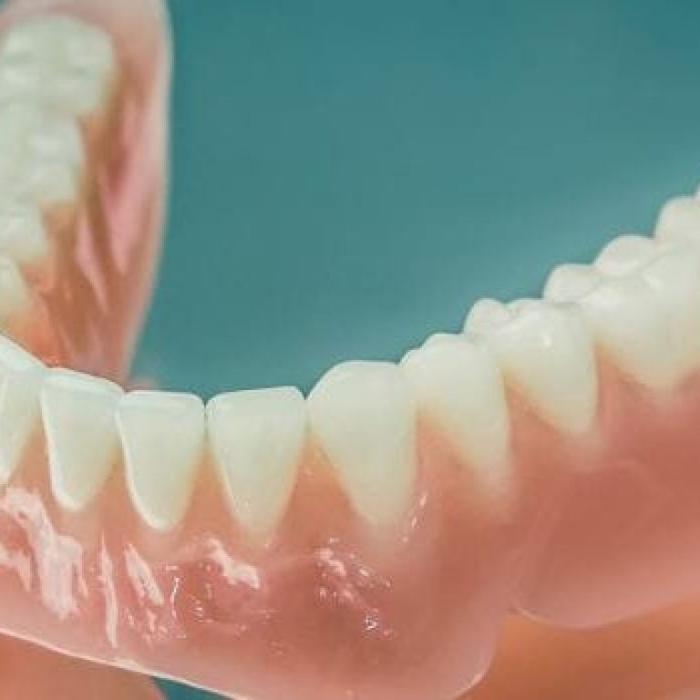 Proteze dentare mobile